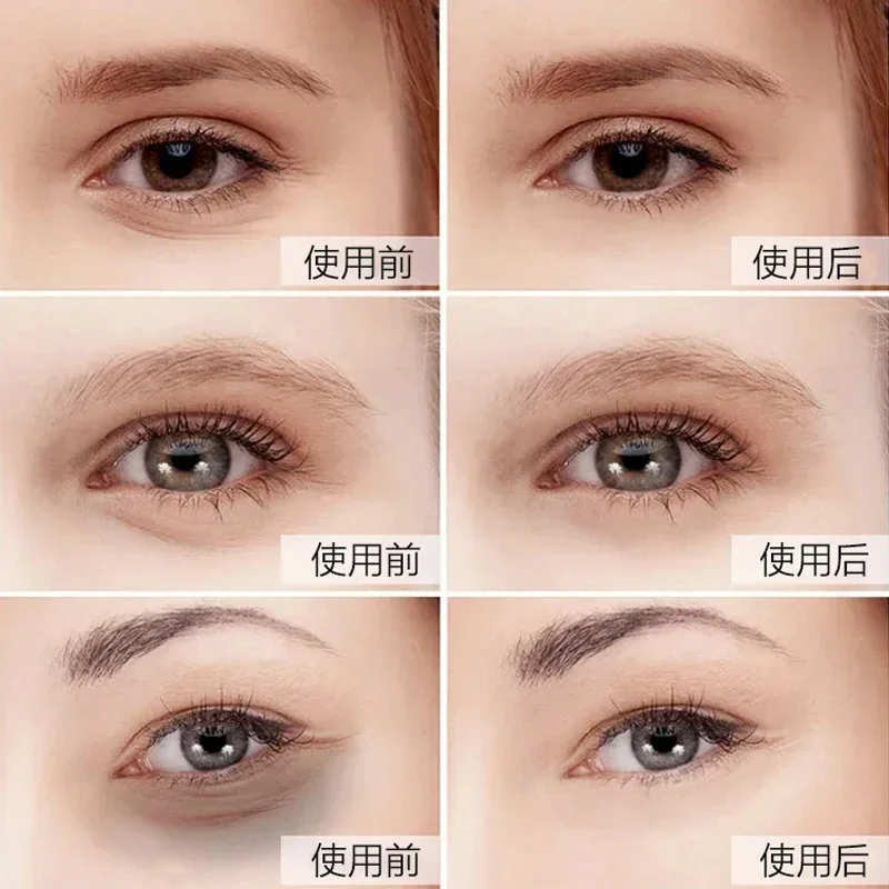 5pair Gold Eye Mask Patches Cr - Eye Pad Collagen recension och pris